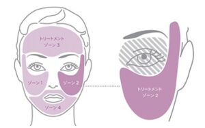 トリア美顔器スキンエイジングケアレーザーの肌のお手入れ方法－照射
